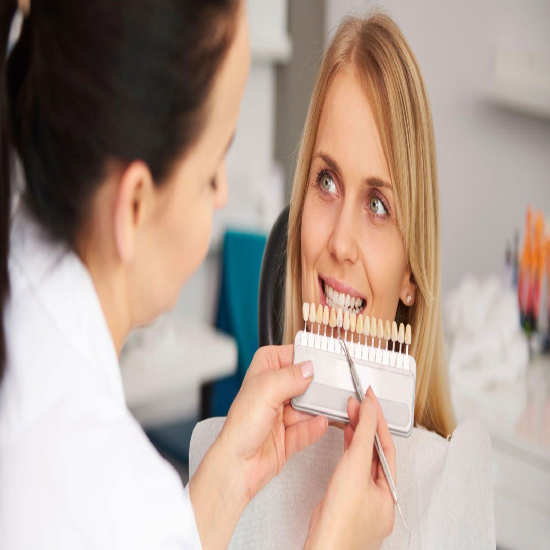 Estetik Diş Kaplamaları: Sorunları İyileştirme İçin Mükemmel Seçenek | 