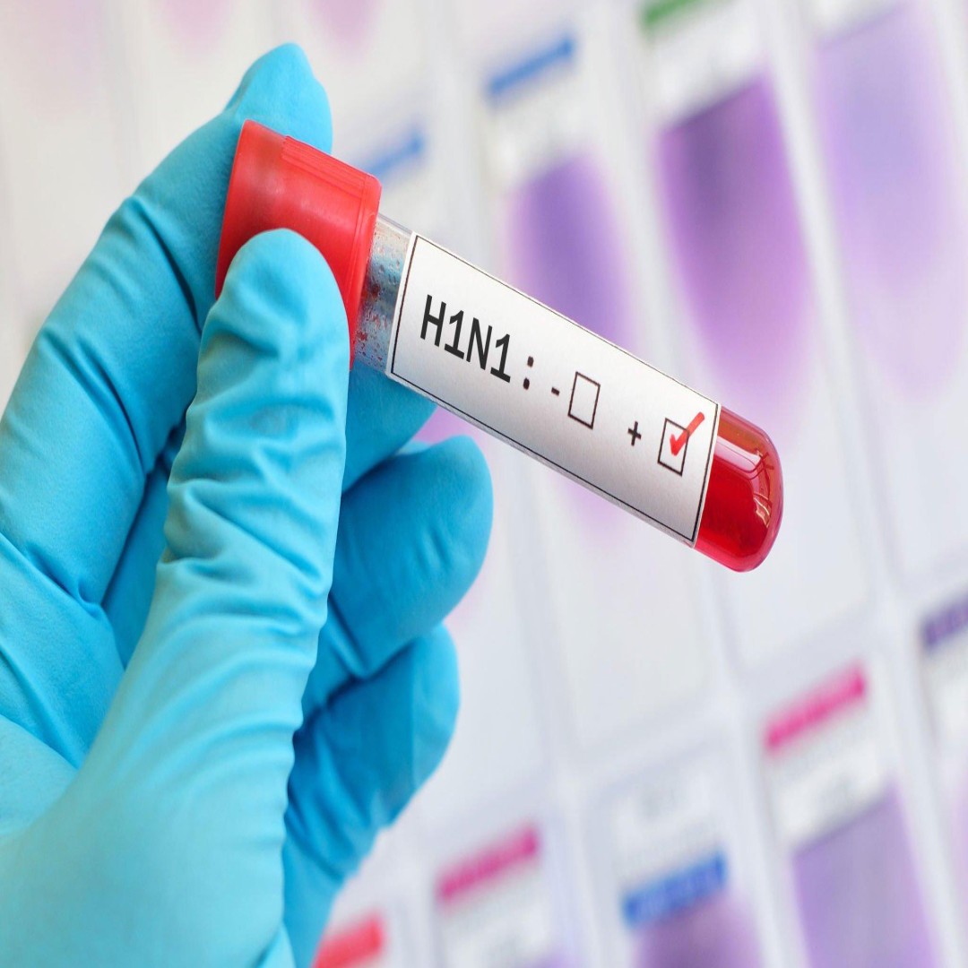 Domuz Gribi Teşhisi: PCR Testi ve Önemi | 